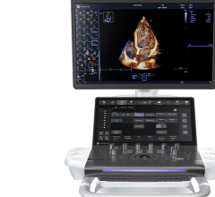 Philips Unveils Compact Version of iE33 Ultrasound | DAIC